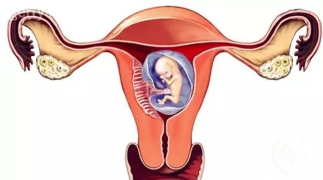 泰国试管备孕必须知道的几大输卵管问题！