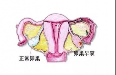 武汉备孕试管婴儿知识_为什么年轻女性也会卵巢早衰？如何防止早衰？